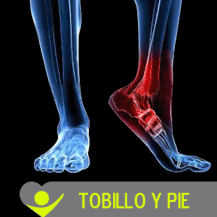 tobillera dual strap en monterrey, tobillera reforzada, tobillera de neopreno, tobillera elastica, plantillas lynco, ferula para tobillo air gel, ferula roksport daonsa, ability monterrey, ability san pedro, fascitis plantar, actimove