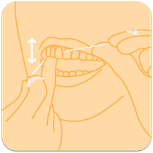 Zahnseide sanft zwischen die Zähne einführen und auf und ab bewegen. (© proDente e.V.)