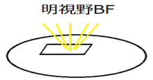 明視野BF