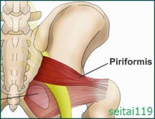 お尻の筋肉が痛い
