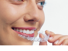 Invisalign