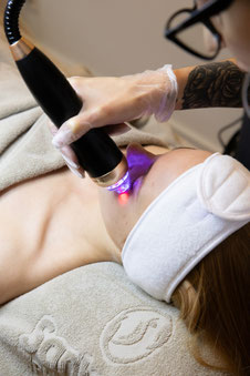 Gesichtsbehandlung Microneedling Basel