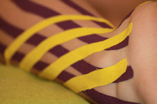 Tape, Kinesio-Tape, Triggerpunkte, Schmerzen, Schmerztherapie, Stabilisierung, Muskeln, Sehnen, Gelenke