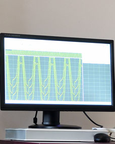 Elektropysiologie: EEG, EMG, NLG, Monitor