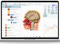 ConCoach: Bio-Photonen-Diagnose