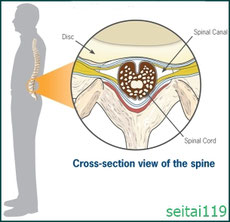 正常な脊柱管