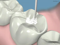 Foto: Odontica