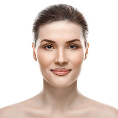 Lippenvolumen