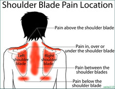 肩甲骨の痛み
