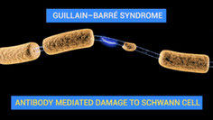 Nervenschädigung (Bild von Dr Jana CC BY 4.0  Wikimedia)