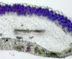 植物の老化と細胞死に関する研究