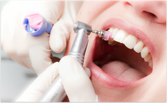 Professionelle Zahnreinigung schützt Sie und Ihr Baby vor schädlichen Bakterien. (© proDente e.V.)