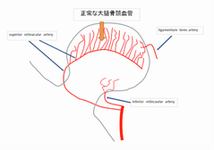 正常な大腿骨　クリックで拡大