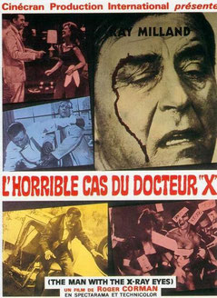  L'Horrible Cas Du Docteur X (1963) 