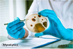 MycoLytics - Kultivierung und Bestimmung, Mikroskopie, Schimmelpilze, Bakterien, Holzzerstörer, Luft-, Staub-, Materialproben 