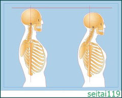 札幌市-悪い姿勢-1