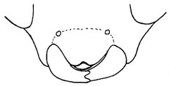 頭盾(前縁中央に切れ込みを有する):ケンランナガハマキヤドリヒメバチ Teleutaea striata (Banchinae).
