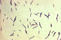 Clostidium Perfingens