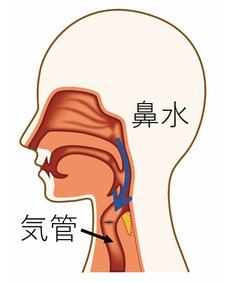 座位では鼻水は、重力により喉に流れ込み気管に向かっていく