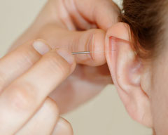  Akupunktur wird eingesetzt bei Rückenschmerzen, Migräne und Verspannungen. Traditionelle Chinesische Medizin