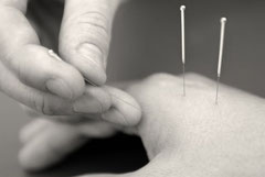 Akupunktur - TCM