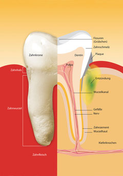 Wie Parodontose beginnt (© Elvira Gerecht - Fotolia.com)