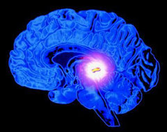 Glândula pineal no cérebro humano