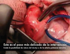 Figura 3
