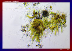 Cyanobacteria (Calothrix sp.)-ca. 150x