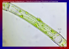 Kappenring-Grünalge (Oedogonium spec.), Fadenzelle mit netzförmigen Chloroplasten und Kappenringe-ca. 300x