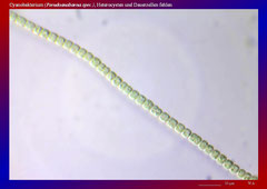 Cyanobakterium (Pseudoanabaena spec.), Heterocysten und Dauerzellen fehlen-ca. 600x