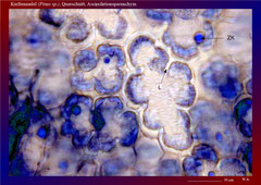 Kiefernnadel (Pinus sp.), Querschnitt, Assimilationsparenchym mit vorspringenden Zellwandleisten und großen Zellkernen - ca. 300x 