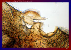 Honigbiene (Apis mellifera),Vorderbein - Putzscharte