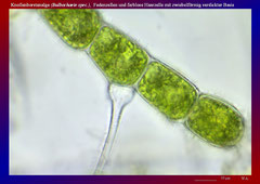 Knollenborstenalge (Bulbochaete spec.), Fadenzellen und farblose Haarzelle mit zwiebelförmig verdickter Basis-ca. 300x