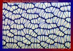 Torfmoos (Sphagnum palustre), Wasserzellen mit spangenartigen Verdickungsleisten-ca. 150x