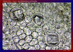 Zitrone (Citrus × limon),  obere Blattepidermis mit Kristallen - ca. 600x 