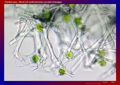 Flechten spec., Mycel mit symbiontischen coccalen Grünalgen-ca. 300x