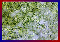 Cyanobakterium (Nostoc spec.), unregelmäßig verbogene Zellfäden mit Heterocysten-ca. 300x
