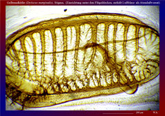 Gelbrandkäfer (Dytiscus marginalis), Stigma, (Einrichtung unter den Flügeldecken, enthält Luftblase als Atemluftvorrat)-ca. 56