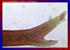 Meeresrotalge (Rhodophyta), - unbestimmt -, Endverzweigung-ca. 70x