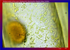 Küchenzwiebel (Allium cepa), Oberhautzelle, Mitochondrien (länglich fädige Gebilde)-ca. 1350x