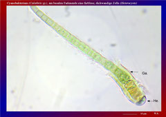 Cyanobakterium (Calothrix sp.), am basalen Fadenende eine farblose, dickwandige Zelle (Heterocyste)