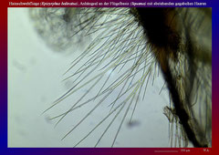 Hainschwebfliege (Episyrphus balteatus), Anhängsel an der Flügelbasis (Squama) mit abstehenden gegabelten Haaren-ca. 70x