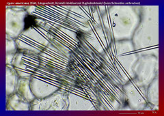 Agave americana, Blatt, Längsschnitt, Kristall-Idioblast mit Raphidenbündel (beim Schneiden zerbrochen)-ca. 150x