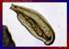 Foraminiferen (Spiroloculina spec.),  Mittelmeer, rezent-ca. 150x