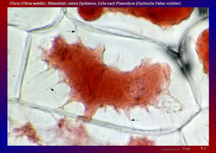 Clivie (Clivia nobilis), Blütenblatt, untere Epidermis, Zelle nach Plasmolyse (Hechtsche Fäden sichtbar)-ca. 600x