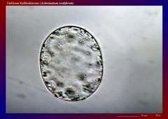 Farbloses Kalkbakterium (Achromatium oxaliferum)-ca. 300x