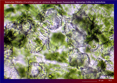 Steirischer Ölkürbis (Cucurbita pepo var. styriaca), Kern, innere Samenschale, eigenartige Zellen im Aerenchym - ca. 300x 