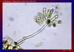 Gelbgrünalge - Schlangenbaum  (Ophiocytium arbuscula) - 300x