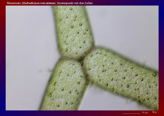 Wassernetz (Hydrodictyon reticulatum), Knotenpunkt mit drei Zellen-ca. 150x